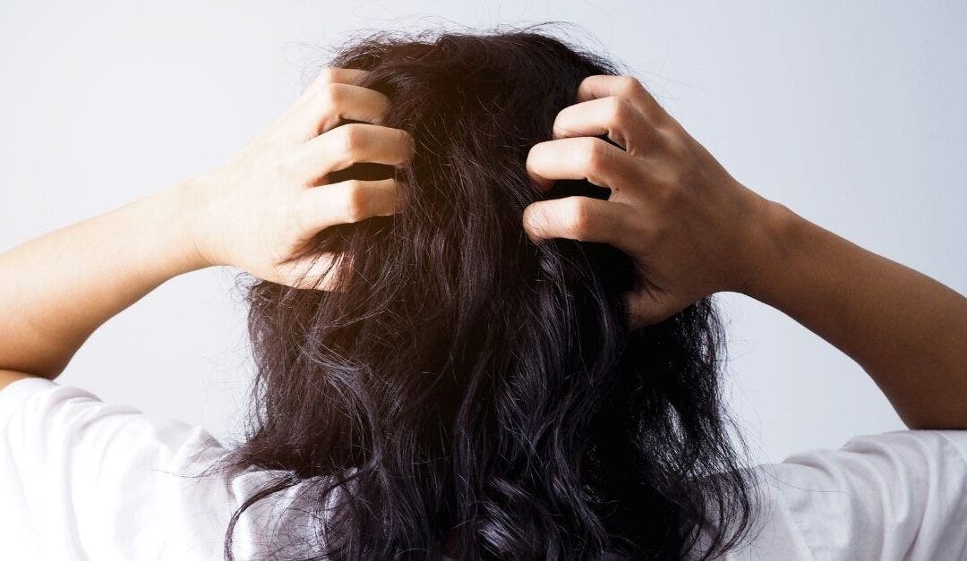 ¿Puede ser perjudicial pasar muchos días sin lavarse el cabello?